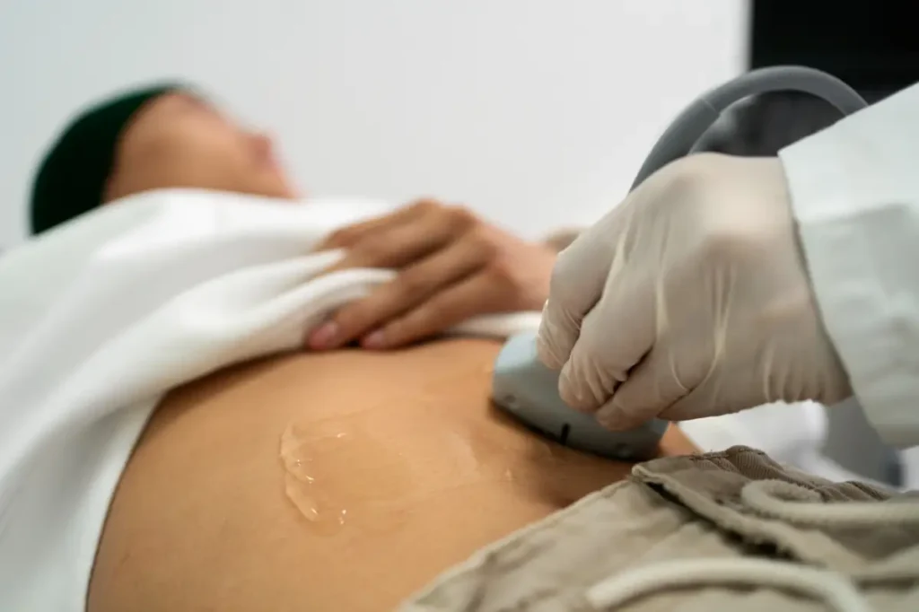 radiofrecuencia abdomen